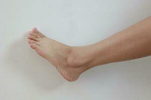 Leg on white background photo