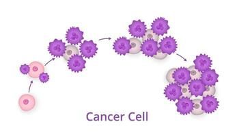 proceso de desarrollo de cáncer células. esquema de progresión de carcinoma con numeroso divisiones onco células ese amortiguar vector sano unos.