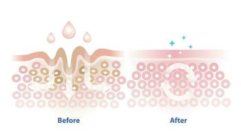 Before and after skincare absorption vector illustration isolated on white background. Cross section of wrinkles skin and skincare absorbing to help reduce aging and damaged skin. Skin care concept.