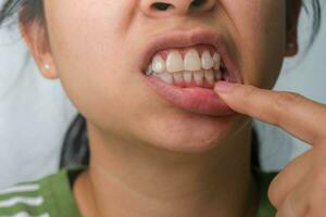 asiático mujer participación su mano en su mejilla sensación dolor de muelas, diente decadencia, gingivitis o malo aliento problema. dolor de muelas y oral salud concepto. foto