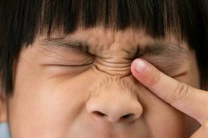 pequeño niña alérgico a polvo frota su ojos de cerca. pequeño niña que produce picor su ojos con lágrima. foto
