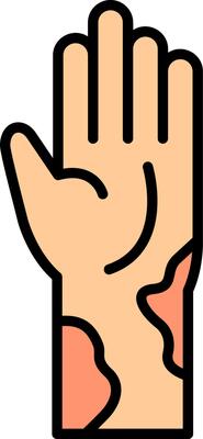 Eczema Vector Icon