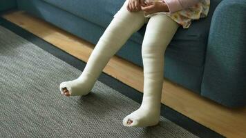 pequeño niño con yeso vendaje en pierna. video