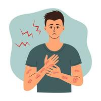 triste hombre sufrimiento desde soriasis, eczema o dermatitis arañazos erupciones en su mano. protección de la piel, medicina y cuidado de la salud concepto. vector