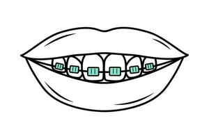 Human mouth with teeth in braces in doodle style. Corrective Orthodontics. Dental care. Linear vector illustration.