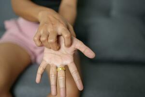 Asian woman has itching on her hands and arms. photo