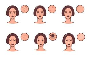 conjunto de hembra caras con varios piel condiciones y problema. protección de la piel y dermatología concepto. vector vistoso ilustración.