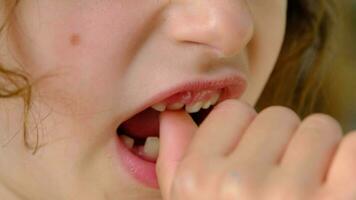 The child shakes the front baby tooth and smiles a toothless smile close-up. Changing teeth to molars in childhood video