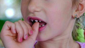 The child shakes the front baby tooth and smiles a toothless smile close-up. Changing teeth to molars in childhood video