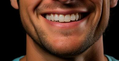 masculino sonrisa de cerca, blanco como la nieve dientes, cosmetología concepto, odontología - ai generado imagen foto