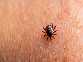 cerca arriba de rojo garrapata con sangre. macro Disparo de humano mano con garrapata. foto