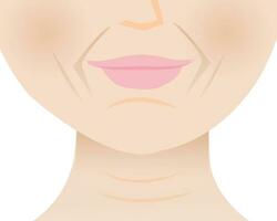 el inferior cara arrugado piel de maduro mujer vector ilustración. marioneta líneas, nasolabial pliegues, sonrisa líneas, mental pliegue y cuello líneas. profundo envejecimiento arrugas en rostro. piel problema concepto.
