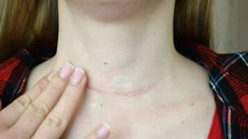 cicatriz después cirugía en mujer cuello video