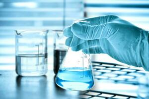 Flask in scientist hand with lab glassware background photo