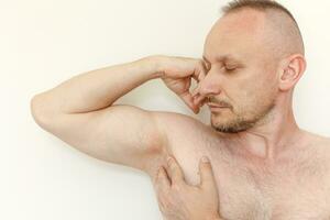 Young man shows irritation on the sensitive skin after using a razor, trimmer, toxic deodorant or antiperspirant. Armpit rash. Allergy, irritation or atopic dermatitis. Acne or red spots underarm. photo