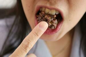 Close-up of a woman's mouth eating food photo