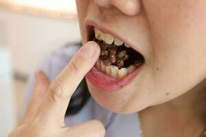 Close-up of a woman's mouth eating food photo