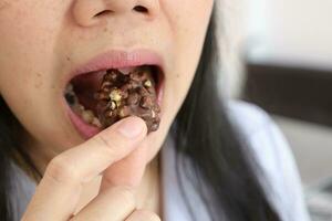 Close-up of a woman's mouth eating food photo