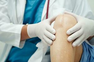 Doctor checking Asian elderly woman patient with scar knee replacement surgery in hospital. photo