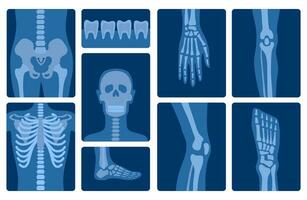 Cartoon Color Xray Shots Human Skeleton Body Parts Set. Vector