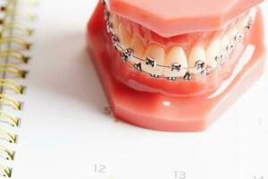 dental cita recordatorio en calendario, sano dientes, dental salud cuidado. foto