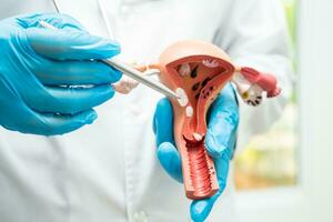 Uterus, doctor holding anatomy model for study diagnosis and treatment in hospital. photo