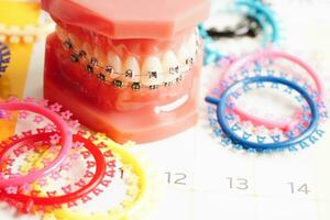 Orthodontic ligatures rings and ties, elastic rubber bands on orthodontic braces, model for dentist studying about dentistry. photo