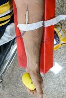 donante de sangre en el campamento de donación de sangre sostenido con una pelota hinchable en la mano en el templo balaji, vivek vihar, delhi, india, imagen para el día mundial del donante de sangre el 14 de junio de cada año, campamento de donación de sangre foto