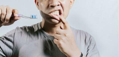 persona con gingivitis participación cepillo de dientes. personas participación cepillo de dientes con goma dolor. hombre participación cepillo de dientes con goma dolor, personas participación cepillo de dientes con goma problema aislado foto