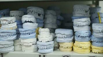 Place of storage of plaster models of human jaws in an orthodontic clinic. Control and diagnostic dental casts video