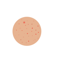 Acne Skin with Red Dots png