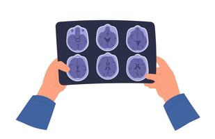 Brain MRI scan. Magnetic resonance imaging. Hand holding image. Flat vector illustration.