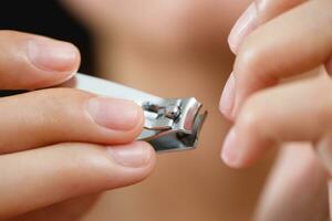 Clean and cut dirty nails to prevent germs and bacteria. photo