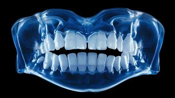 x-ray of human dental, blue tone radiograph on dark background, Diagnostic Tool for Dental Examination and Diagnosis, Ai generative photo