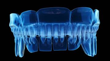 radiografía de humano dental, azul tono radiografía en oscuro fondo, diagnóstico herramienta para dental examen y diagnóstico, ai generativo foto