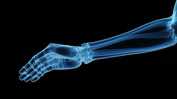 Orthopedic Excellence, Detailed X-Ray of a Male Human Arm in Blue Tones on a Black Background - Ideal for Precise Medical Imaging and Diagnosis, Ai generative photo