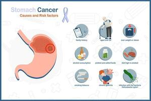 médico conceptos de causas y riesgo factores de estómago cáncer.obesidad, terminado 60 60 años de edad, fumar, comer en escabeche y salado comidas incluso ahumado alimentos, infección con bacterias helicobacter píloros. vector