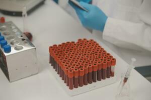 investigadores de atención médica que trabajan en el laboratorio de ciencias de la vida. joven científica investigadora y supervisora masculina senior preparando y analizando portaobjetos de microscopio en el laboratorio de investigación. foto