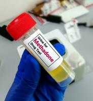 Urine sample for Methadone Drug test, photo