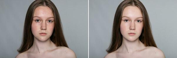 Before and after cosmetic operation. Young pretty woman portrait photo