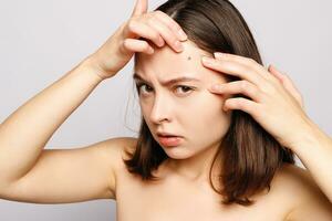 Portrait of young attractive woman touching her face and looking for acne photo