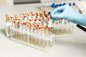 A chemical sample bottle. Centrifuge. A test tube vial sets for analysis. photo