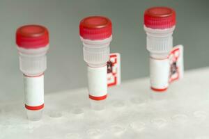 Test tubes arranged on medical trolley photo