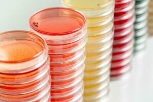 Red and yellow petri dishes stacks in microbiology lab on the bacteriology laboratory background. photo