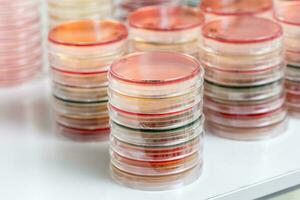 Red and yellow petri dishes stacks in microbiology lab on the bacteriology laboratory background. photo