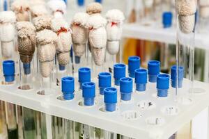 Test tubes arranged on medical trolley photo