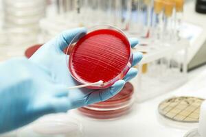 lab technician hand planting a petri dish photo