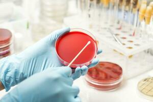 lab technician hand planting a petri dish photo