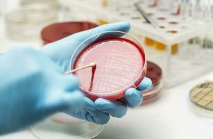 lab technician hand planting a petri dish photo