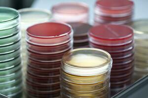 Red and yellow petri dishes stacks in microbiology lab on the bacteriology laboratory background. photo